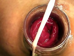 Gaped fuckhole March-15-2015
