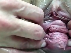 Working on my prolapse