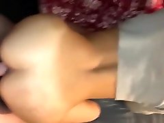 прональный кость с колледж gf