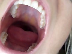home pooping mms Roof Mouth