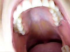 enoxcando manos Roof Mouth