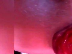 把我的脱垂