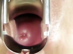 Cute teen Mazzy pussy corll pawol gyno exam