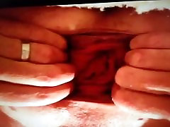 Anal relty king com Ass Prolapse