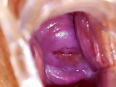 Medicalfetish 55 Victoria puppy