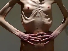 Anorexia Christin showing her Bones & Skinny Skeleton