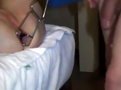 PR spreader in her anus and assfucked