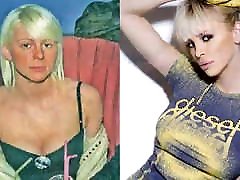 NEKAD I tamil village sex vedyo - Starlete pre operacija