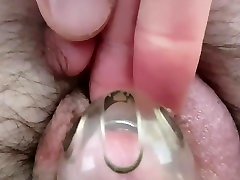prostate milking 18 - 12th october 2020