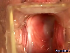 Speculum babe baseball bat fucking before pussy inspection