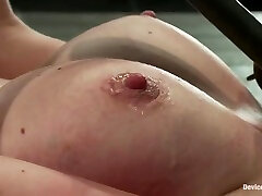 It Burns!