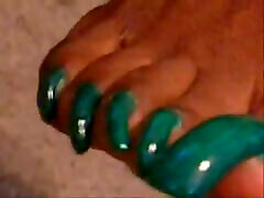 Long green toenails
