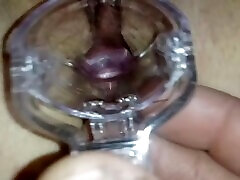 stepsister let me play dr with speculum to see her making grool inside