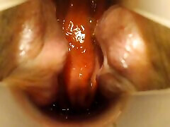 Anal speculum and show inside my asshole